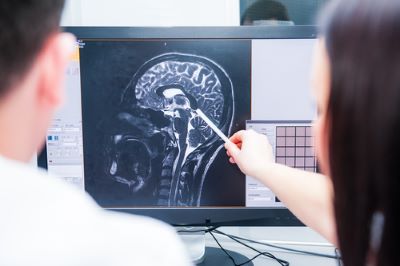 Doctors examining brain scan